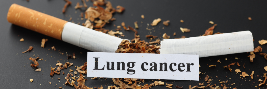 Lung Cancer and Cigarettes