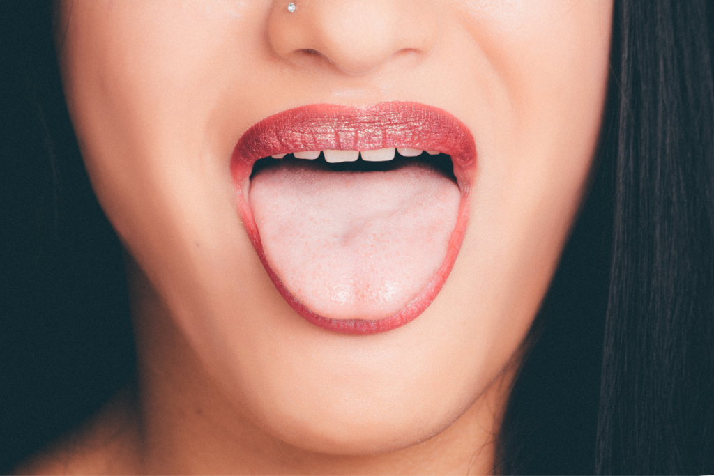 diabetic tongue