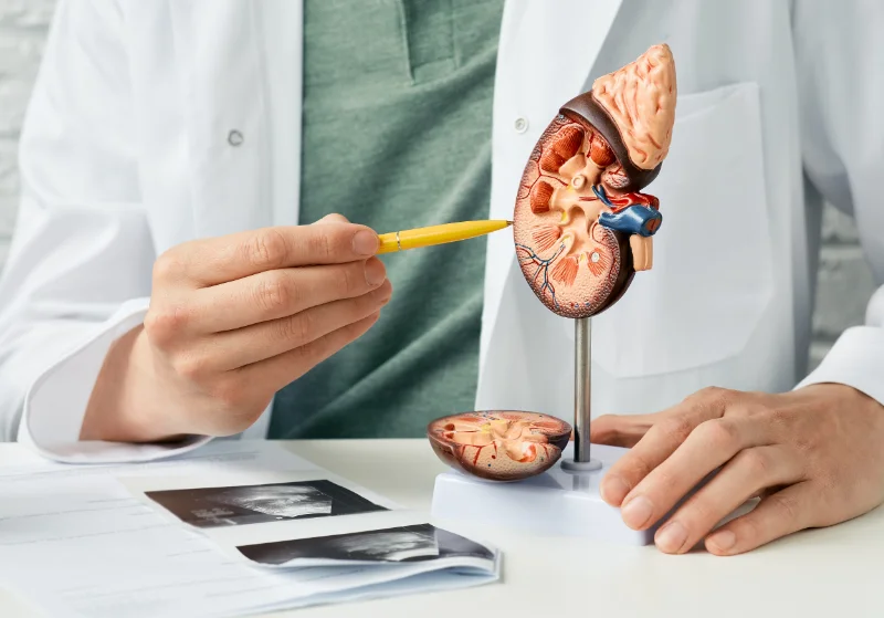 A doctor showing a diseased kidney and how it relates to trying to get rid of metallic taste